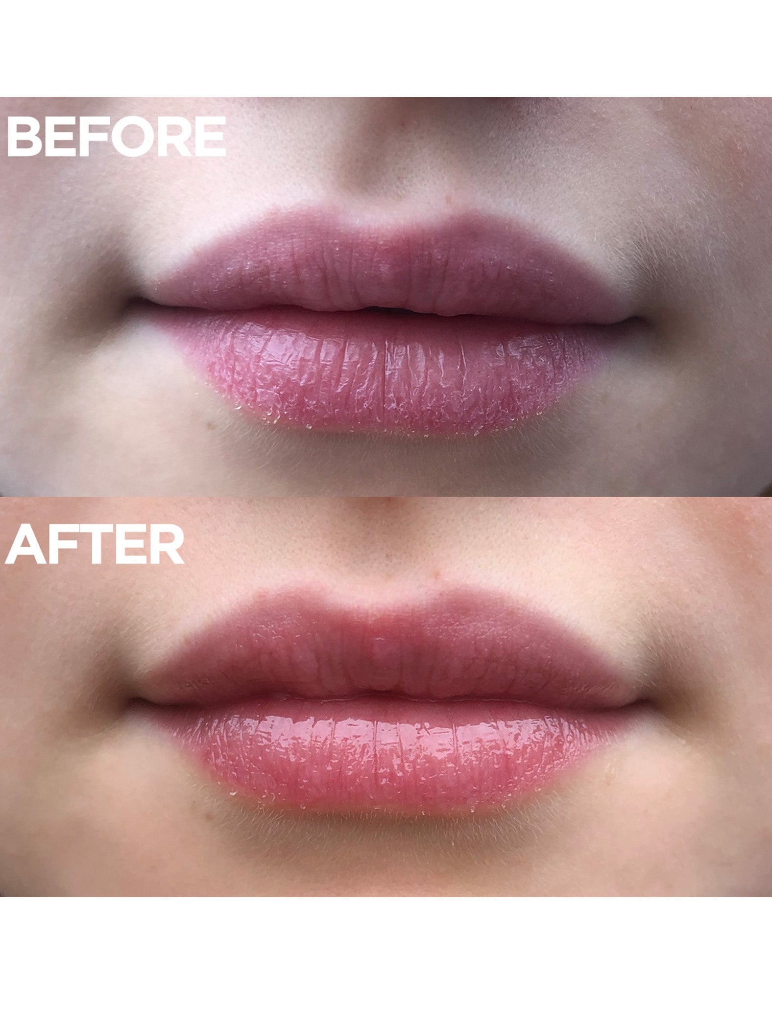 Before and after image showing dry, chapped lips transformed to soft, hydrated lips using Lanolips 101 Ointment. Formulated with ultra-pure grade Aussie lanolin, this 100% natural balm is a safe, non-greasy alternative to petroleum. Safe for pregnancy, babies, and nursing mothers.