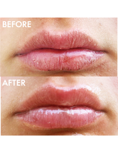 101 Ointment. 101 Uses. 100% Natural | Load image into Gallery viewer, Before &amp; Afters
