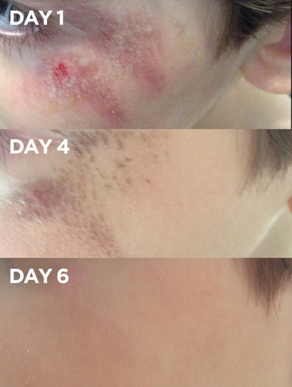 Lanolips before & after of a models face using golden dry skin miracle salve.