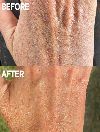 Lanolips before & after of a models hand using golden dry skin miracle salve.