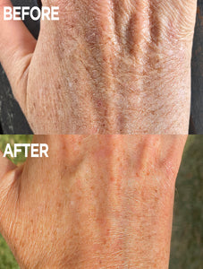 Before & After of Hand using Golden Dry Skin Miracle Salve | Lanolips