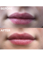 101 Ointment. 101 Uses. 100% Natural | Load image into Gallery viewer, Before &amp; Afters
